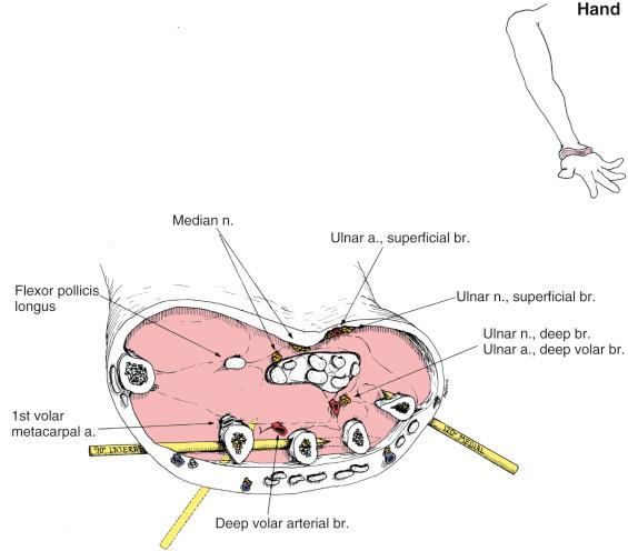 Fig. 8.26, Hand. Anatomic Considerations.