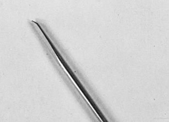 Fig. 8.29, The bayonet point of an Ilizarov wire can twist soft tissue, causing necrosis.