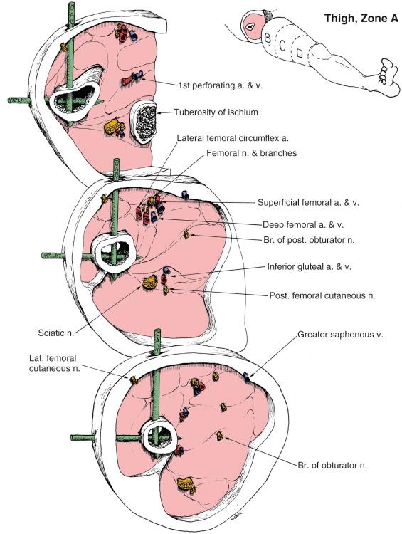 Fig. 8.9, Thigh Zone A. Anatomic Considerations.
