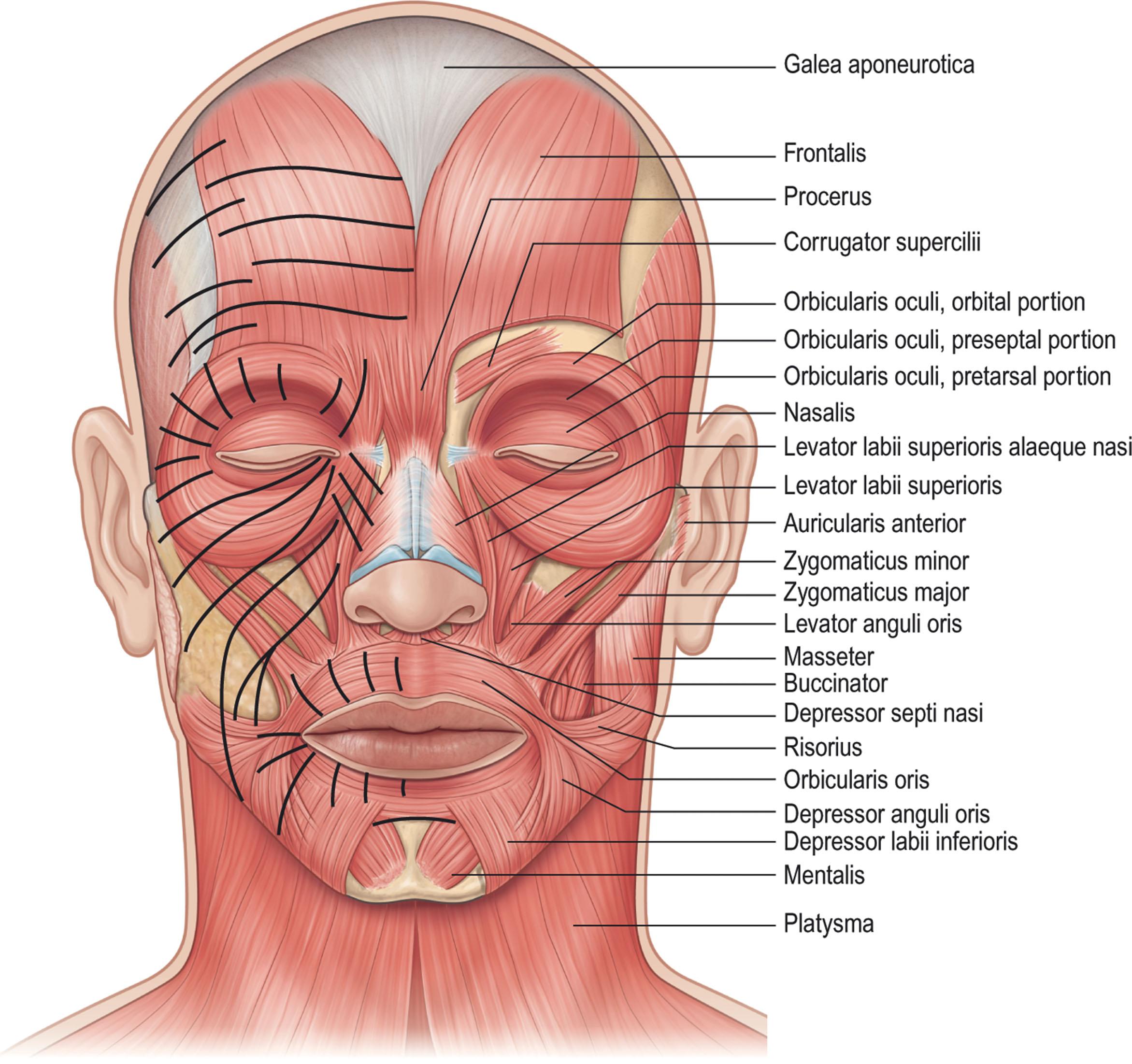 Figure 9.3.3, Muscles of facial expression. The solid lines demonstrate overlying skin creases caused by repeated contraction of the underlying muscles.
