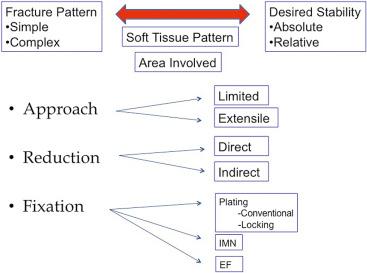 Fig. 9.1, Summary flowchart of the system of fracture care. The process moves from an evaluation of the fracture pattern toward a decision regarding desired construct stability. Once this choice is made, further decision points required include surgical exposure, reduction method, and fixation choice. Each decision box is covered in detail in this chapter with the exception of external fixation (which is covered in Chapter 8 ). Although we will separately cover the individual parts, the system must be considered as an integrated whole for successful fracture management. EF, External fixation; IMN, intramedullary nail.