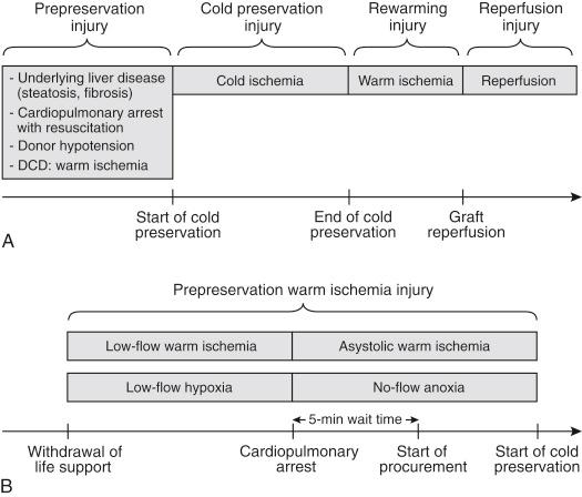 FIGURE 44-1, A, Components of preservation injury. B, Livers from donation after cardiac death (DCD) donors experience warm ischemia injury as part of prepreservation injury.