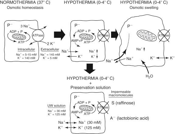 FIGURE 44-3, Pathophysiology and prevention of hypothermia-induced cell swelling. Under normothermia the osmotic hemostasis is maintained by the Na + ,K + -adenosine triphosphatase (ATPase) pump, which creates the Na + and K + gradient between the extracellular and intracellular compartment. During hypothermia the Na + ,K + -ATPase pump is completely inhibited by hypothermia and adenosine triphosphate (ATP) depletion, resulting in sodium influx into the cell, which is further enforced by intracellular negatively charged proteins (P − ). The intracellular hyperosmolarity results in water uptake and cell swelling. University of Wisconsin (UW) preservation solution mimics the intracellular electrolyte composition and therefore prevents the sodium influx and potassium efflux. In addition, the large impermeable macromolecules S (raffinose) and A − (lactobionic acid) are the extracellular opponent to intracellular P −- . Both electrolyte and macromolecules of UW solution prevent hypothermia-induced cell swelling. ADP , Adenosine diphosphate; AMP , adenosine monophosphate.