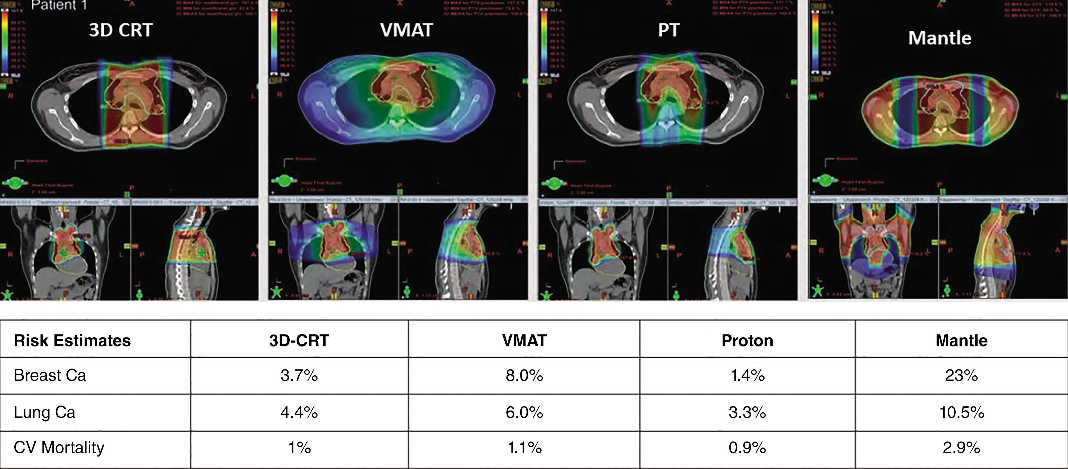 Figure 95.2, MODELING OF DATA ON LATE EFFECT RISKS TO ORGANS AT RISK WITH THE USE OF MODERN RADIOTHERAPY TECHNIQUES.