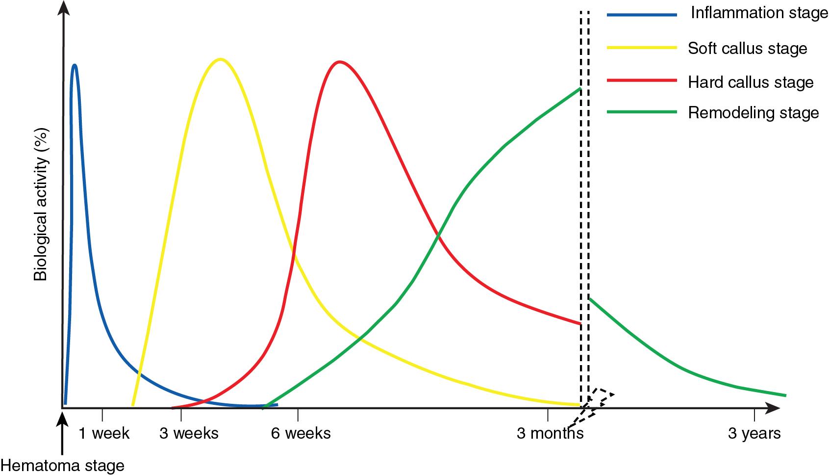 FIGURE 7.1, Stages of secondary bone healing.