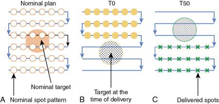 Fig. 5.6, Interplay uncertainties because of dynamic motion and moving target: (A) nominal plan designed at free-breathing phase; (B) when delivering the yellow spots, target on T0 phase does not see any spots; and (C) when delivering green spots, target on T50 phase does not see any spots.