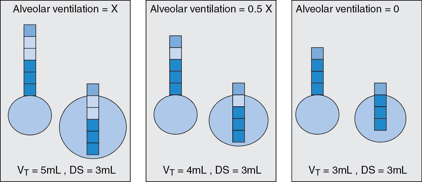 Fig. 10.3, Classical respiratory physiology teaches us that at the end of exhalation, there is exhaled gas (dark boxes) in the large airways that will enter the lungs before any fresh gas (light boxes) can reach the lungs. Therefore alveolar tidal volume = tidal volume − dead space volume. Anatomic dead space is 2mL/kg. In this illustration, the anatomic dead space plus instrumental dead space = 3 mL, typical for a 1 kg infant. In the left panel, we have a tidal volume (V T ) of 5 mL and a dead space volume of 3 mL; thus 2 mL of fresh gas enters the alveoli. Reducing V T from 5 to 4 mL is a 20% reduction in total V T but a 50% reduction in alveolar V T . Further reduction of V T to 3 mL would theoretically result in no alveolar ventilation. Although there is probably some admixture beteween fresh gas and dead space gas, rapid shallow breathing is very inefficient.