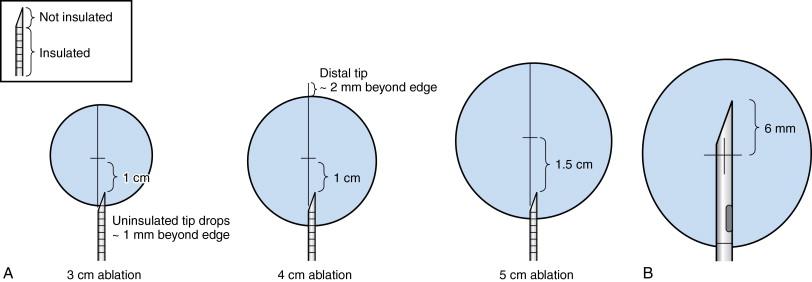 Figure 2-15, (A) Trocar position when using StarBurst XL, Semi-Flex, or MRI-compatible probes. The tip of the trocar should be placed approximately 1 cm (for a 3-cm ablation) to 1.5 cm (for a 5-cm ablation) proximal to the center of the target area. Using the 1-cm markings on the trocar can assist in placement of the device. (B) Trocar position when using StarBurst Talon, SDE probes. The tip of the trocar should be placed approximately 6 mm distal to the center of the target area.