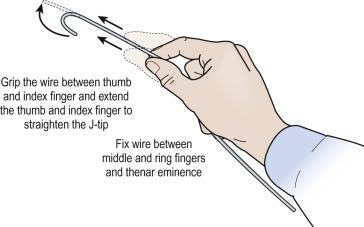 Fig. 28.1, Straightening the J-wire.
