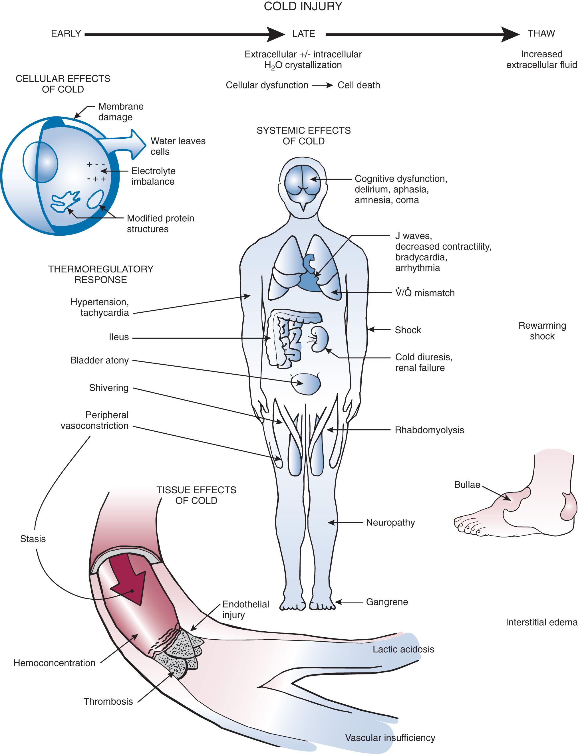 Figure 65.2, Cold-induced injuries such as hypothermia and frostbite lead to a thermoregulatory response (e.g., shivering and increased sympathetic activity), cellular and tissue effects (e.g., membrane damage, electrolyte imbalance, endothelial injury, and thrombosis), and systemic effects (e.g., shock, arrhythmia, and neuromuscular dysfunction).