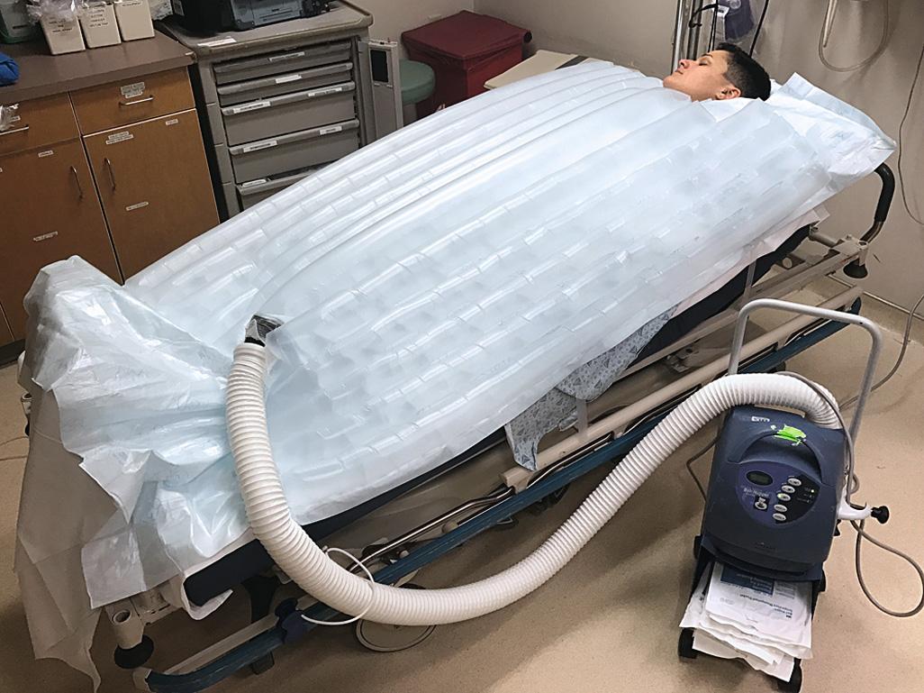 Figure 65.4, Forced warm air convection systems, such as the Bair Hugger (Augustine Medical, Eden Prarie, MN) may be used for active external warming of accidental hypothermia victims.