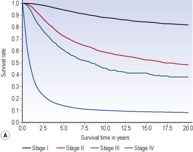Figure 26.1, 2009 American Joint Committee on Cancer (AJCC) melanoma staging system. A) Survival curves for patients with localized melanoma (stages I and II), regional metastases (stage III), and distant metastases (stage IV). The differences between the curves are highly significant (p<0.0001). B) Stage I/II survival by substage groupings for stages I and II melanoma. C) Stage III melanoma by substage. D) Stage IV melanoma survival by site of distant metastases (*Note – LDH level NOT included in this graph). The numbers in parentheses are the numbers of patients from the AJCC 2008 melanoma staging database used to calculate the survival rates.