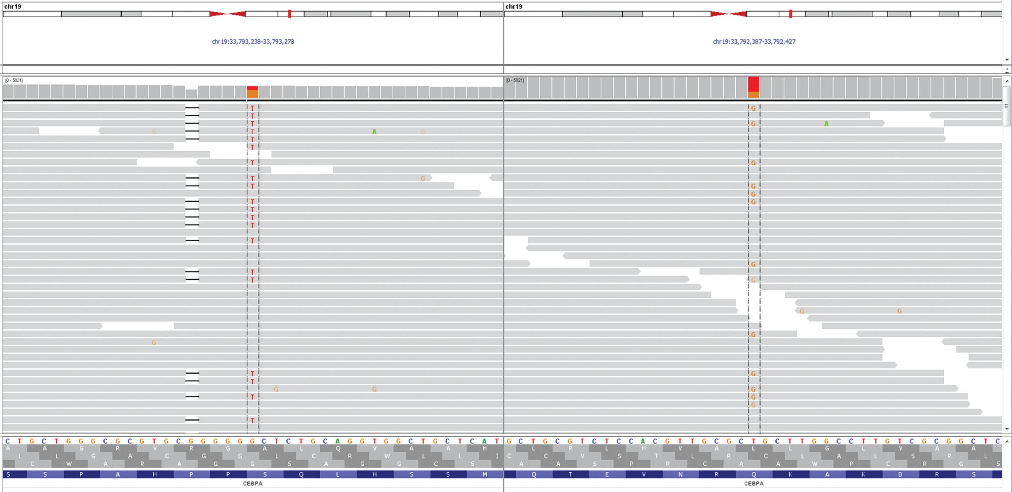 Figure 56.1, ALIGNMENT DATA OF INTEGRATIVE GENOMICS VIEWER FOR DOUBLE CEBPA MUTATIONS IDENTIFIED IN AN AML PATIENT.