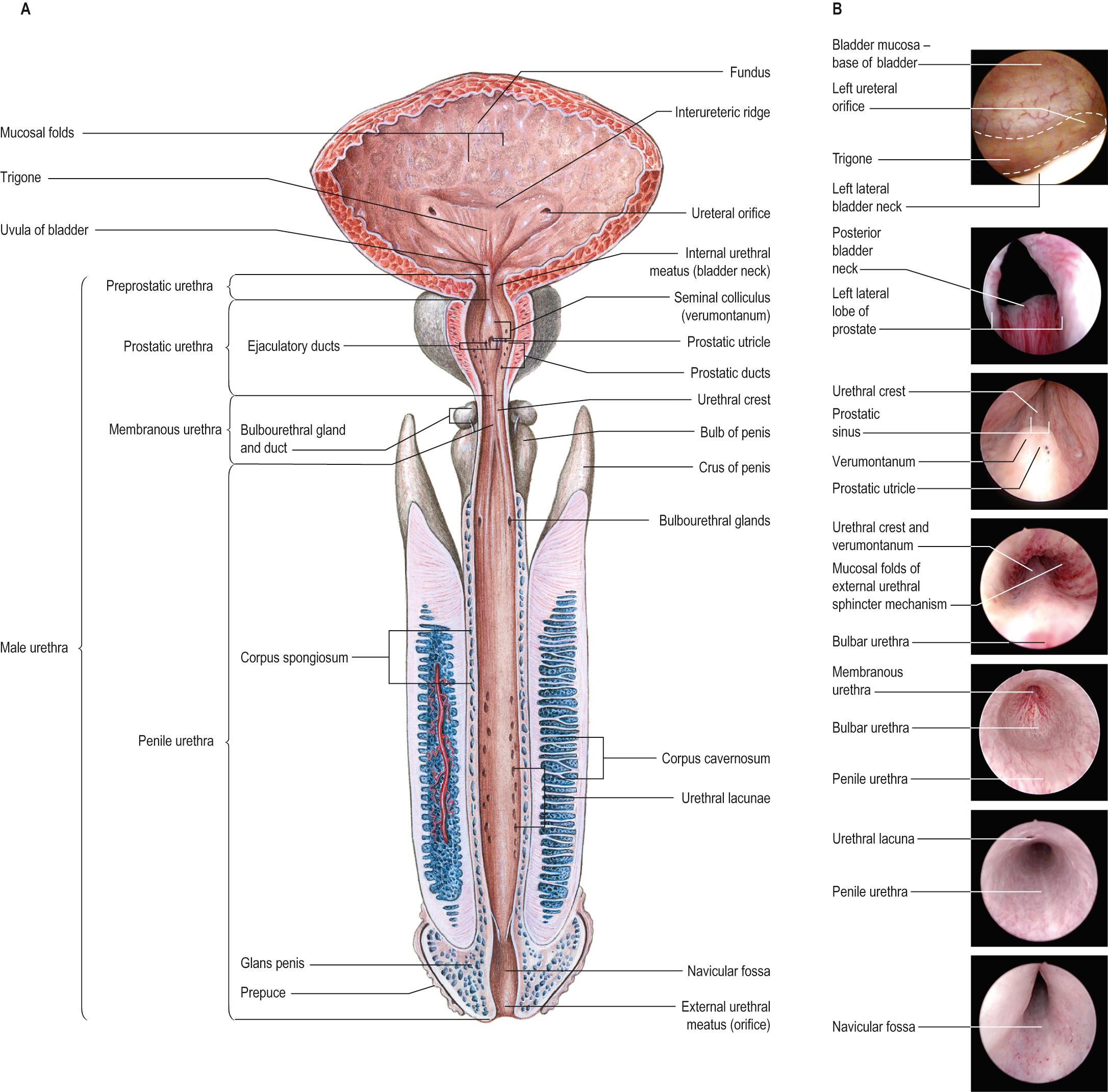 Fig. 73.1, A , The male urethra. B , Endoscopic views (from top): posterior bladder wall and trigone, bladder neck, verumontanum, membranous urethra, bulbar urethra, penile urethra, navicular fossa.