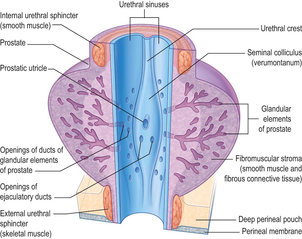 Fig. 73.2, The prostatic part of the male urethra. The raised part of the urethral crest is the seminal colliculus or verumontanum.