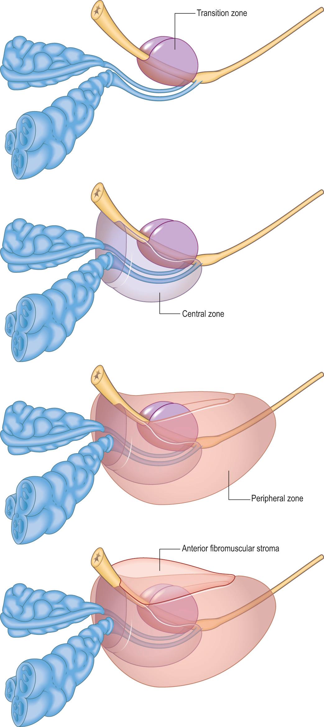 Fig. 73.4, The zonal anatomy of the prostate.