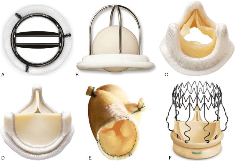 Fig. 26.1, Different Types of Prosthetic Valve Models.