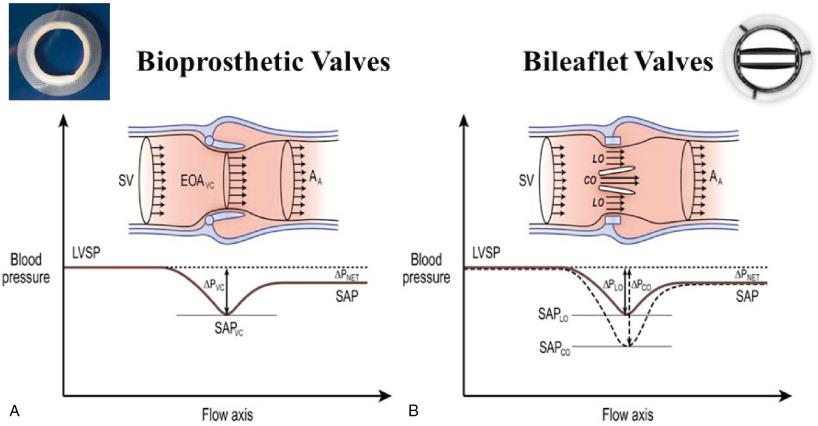 Fig. 26.2, Pressure Recovery.