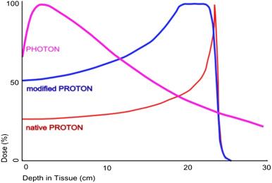 Figure 32.1, Absorption doses of native (red) and modified (blue) 250-MeV proton beams compared with a 6-MV photon (X-ray) beam. The tissue depths shown on the bottom axis are greater than would be used for base of skull tumors, but the principle is the same for tumors of any depth; beam energy is modulated to adjust. Modified (spread out) beams are generally used in treating base of skull tumors; the extent to which the Bragg peak (illustrated in the native beam) is spread out depends on the target volume.