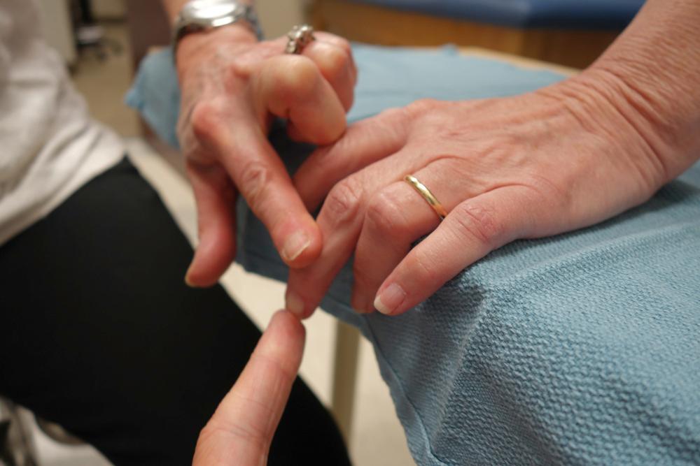 Fig. 80.3, Demonstration of Elson test—the metacarpophalangeal joint is extended, and the proximal interphalangeal joint is flexed over the edge of the table. The middle phalanx is extended against resistance. While resisting the middle phalanx extension, the distal phalanx is evaluated and should be easily flexible, indicating intact central slip. If the distal interphalangeal joint is firm/rigid, this indicates the central slip is not in continuity and the pull of the extensor mechanism is directed solely to the terminal tendon.