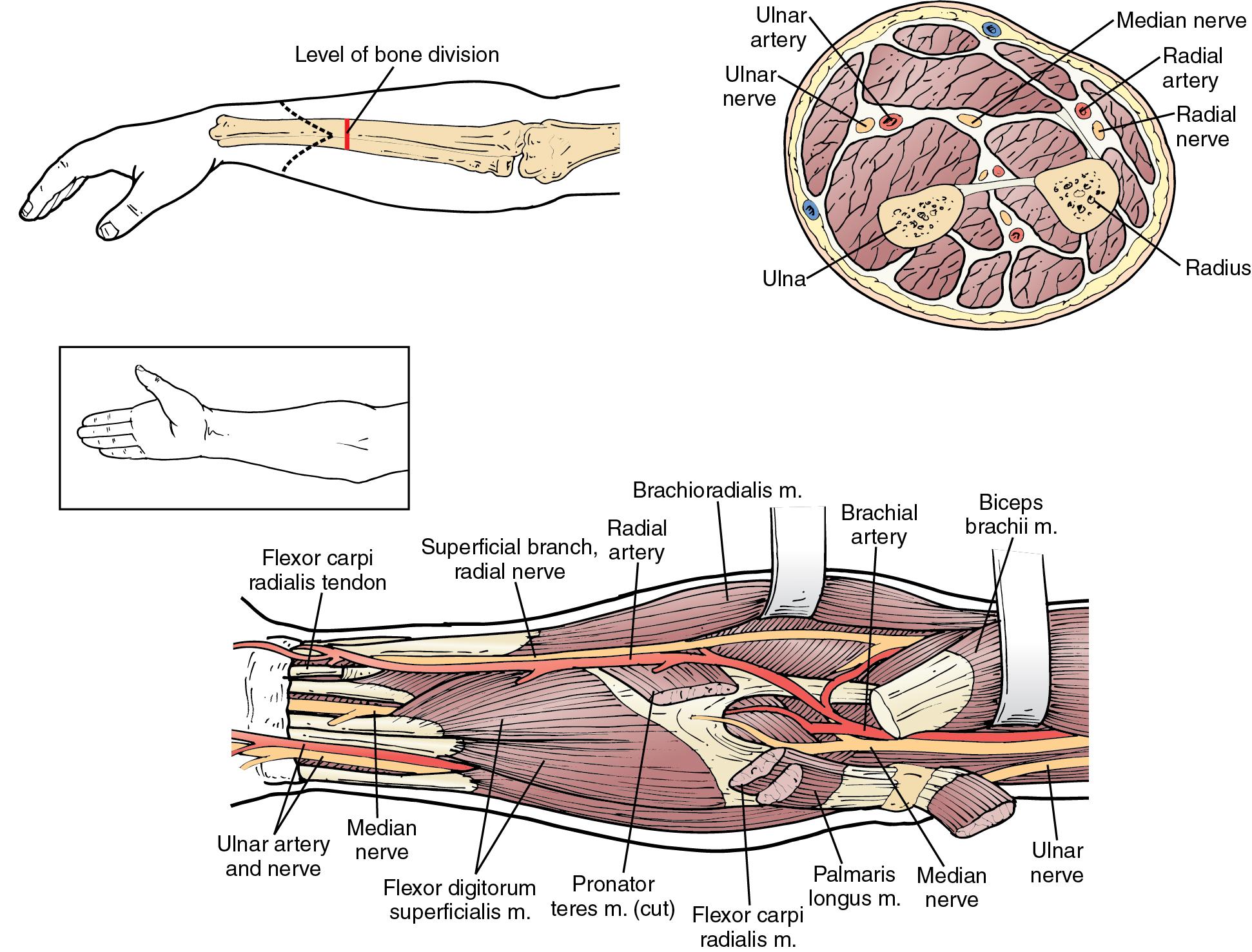 FIGURE 4.1, Forearm anatomy.