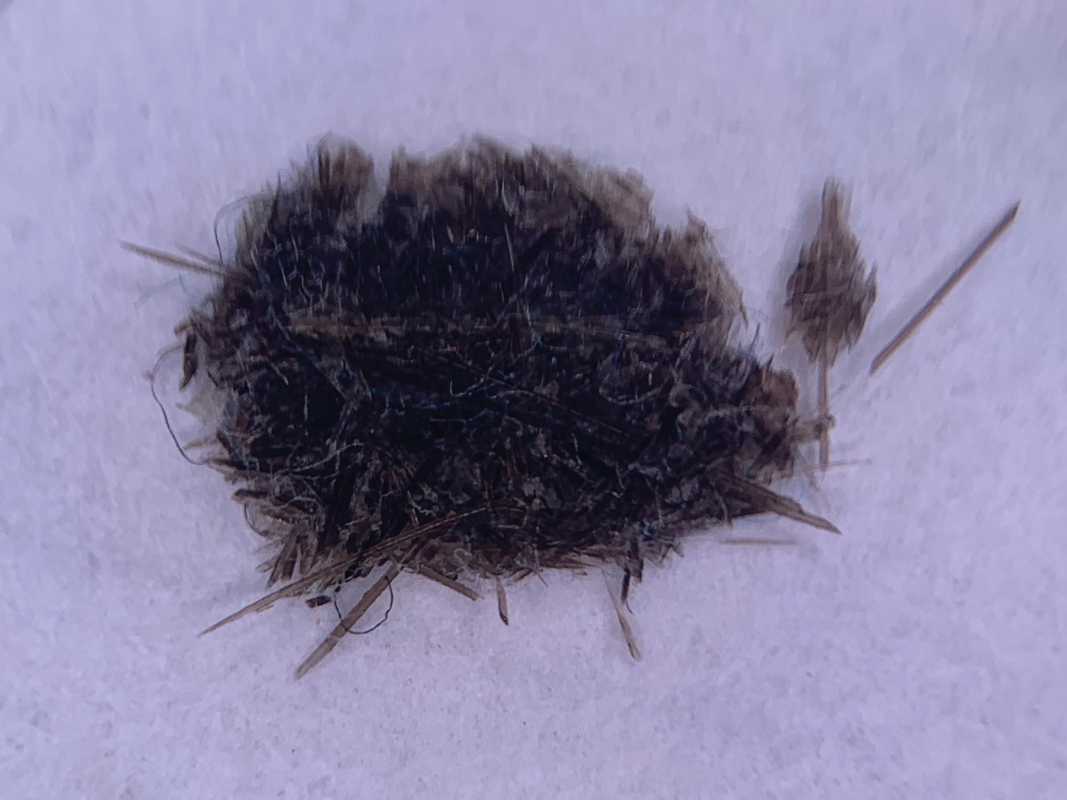 Fig 11.1, An adolescent with delusions of parasitosis presented with a bag of debris collected from the back of his scalp, which on microscopic examination showed shaved hair and scale.