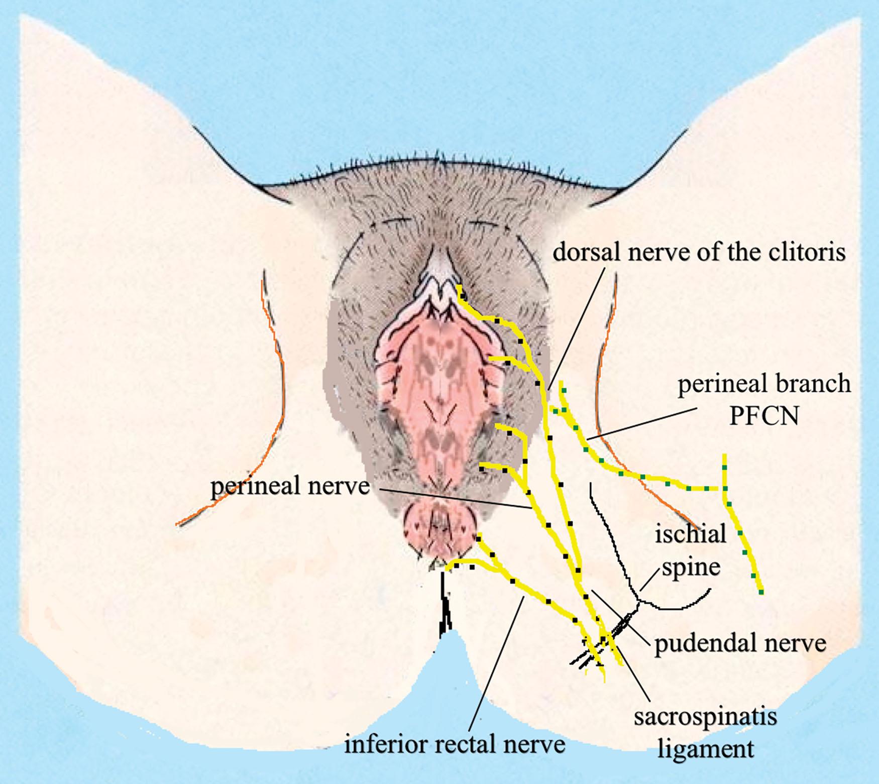 Figure 22.2, Schematic image of the perineal view of the pudendal nerves. PFCN , Posterior femoral cutaneous nerve.