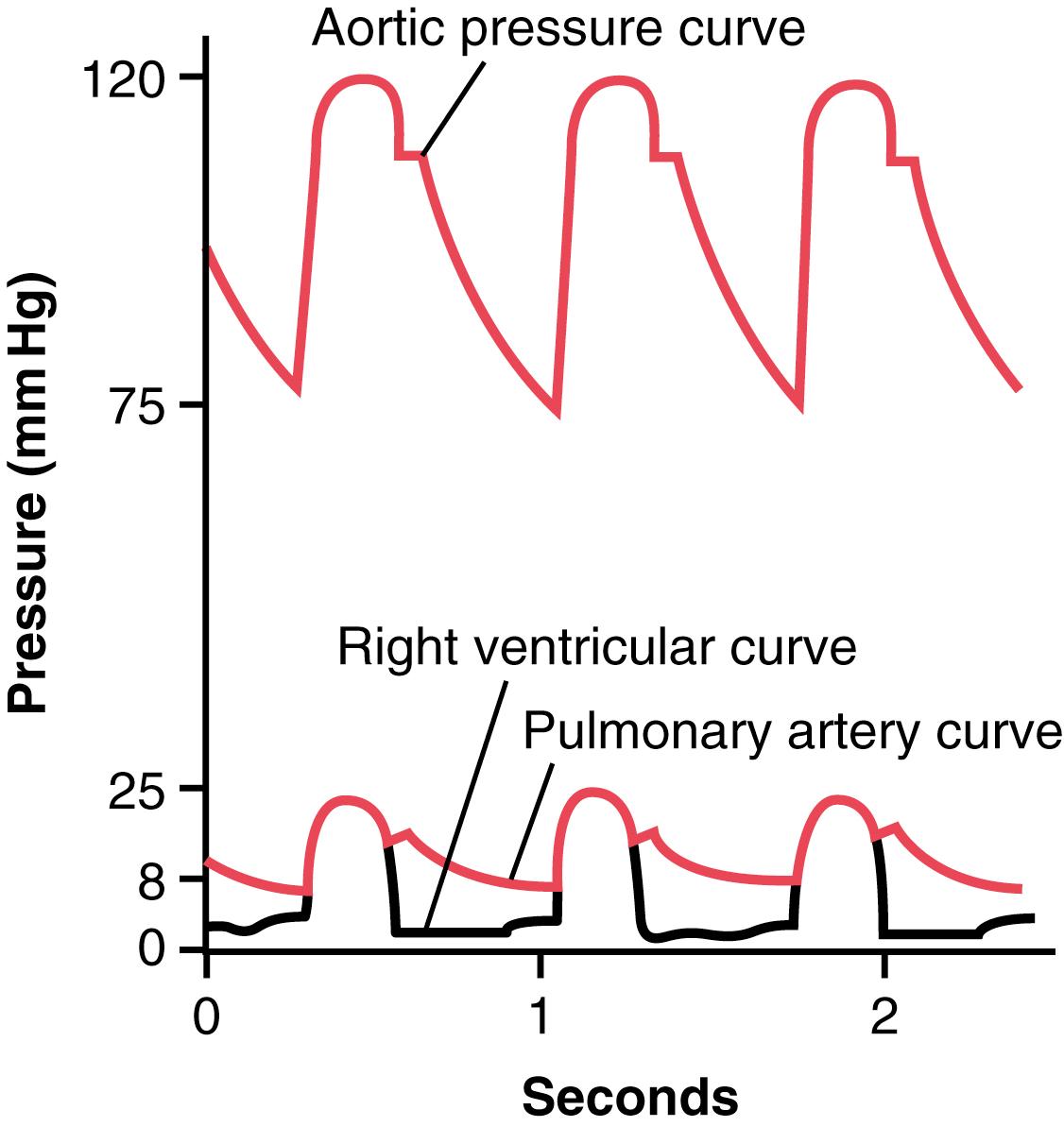 Figure 39-1, Pressure pulse contours in the right ventricle, pulmonary artery, and aorta.