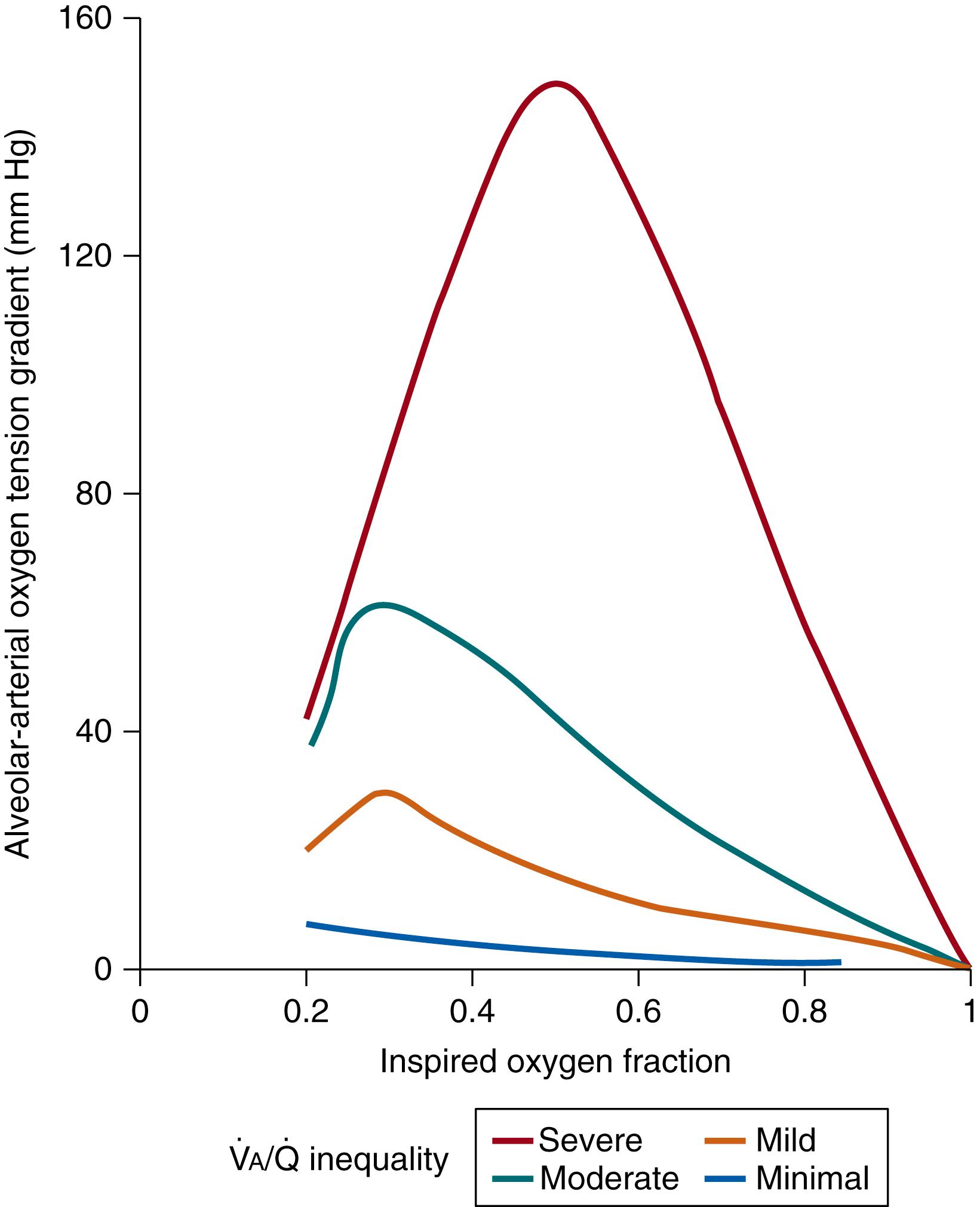 Fig. 64.3, The effects of changes in inspired oxygen fraction, shown on the abscissa, on the calculated alveolar-arterial oxygen gradient are plotted for various degrees of V˙/Q˙ V˙/Q˙ inequality without any coexisting shunt.