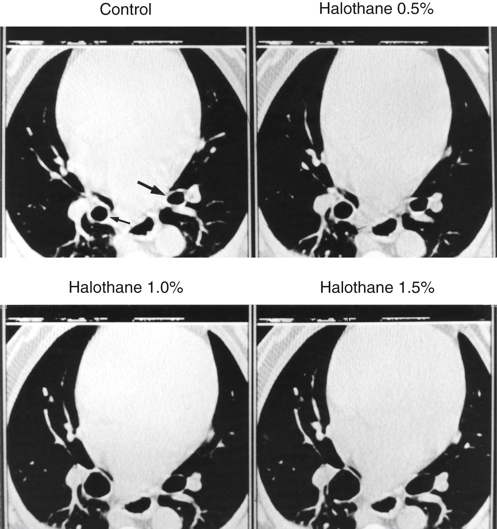 Fig. 21.2, High-resolution computed tomography scans from one dog.