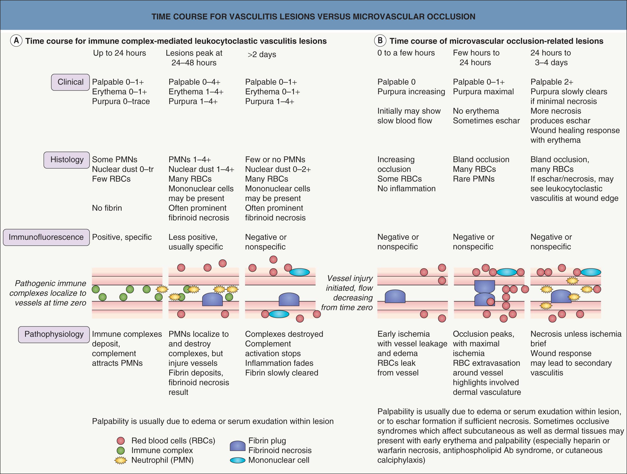 Fig. 22.3, Time course for skin lesions due to vasculitis versus microvascular occlusion.