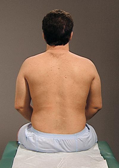 FIG. 24.3, Examine the patient’s back without the gown.