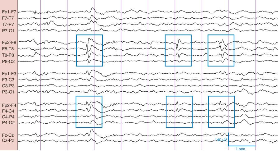 Figure 1Q2