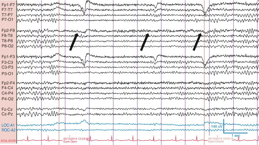 Figure 1Q4