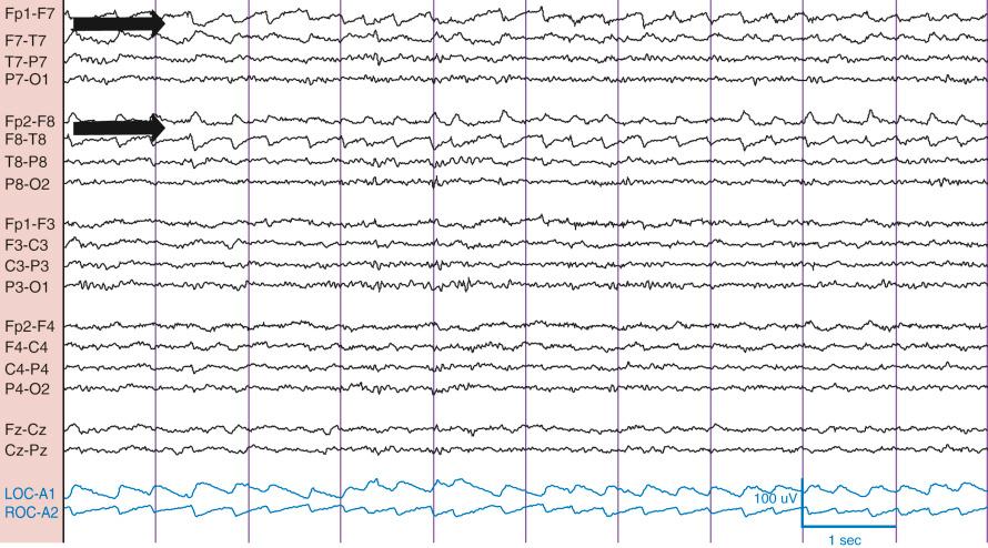 Figure 1Q5