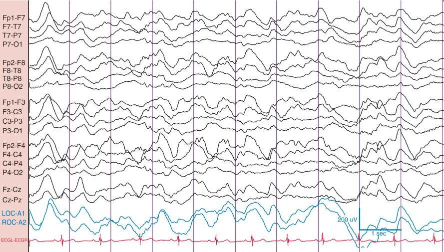 Figure 2Q1