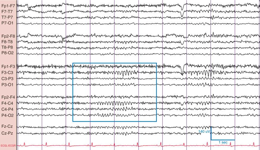 Figure 2Q2