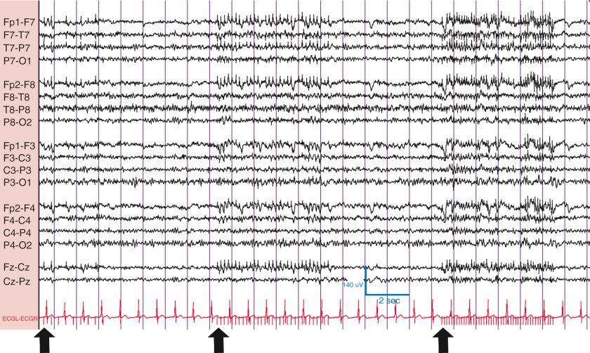 Figure 2Q4