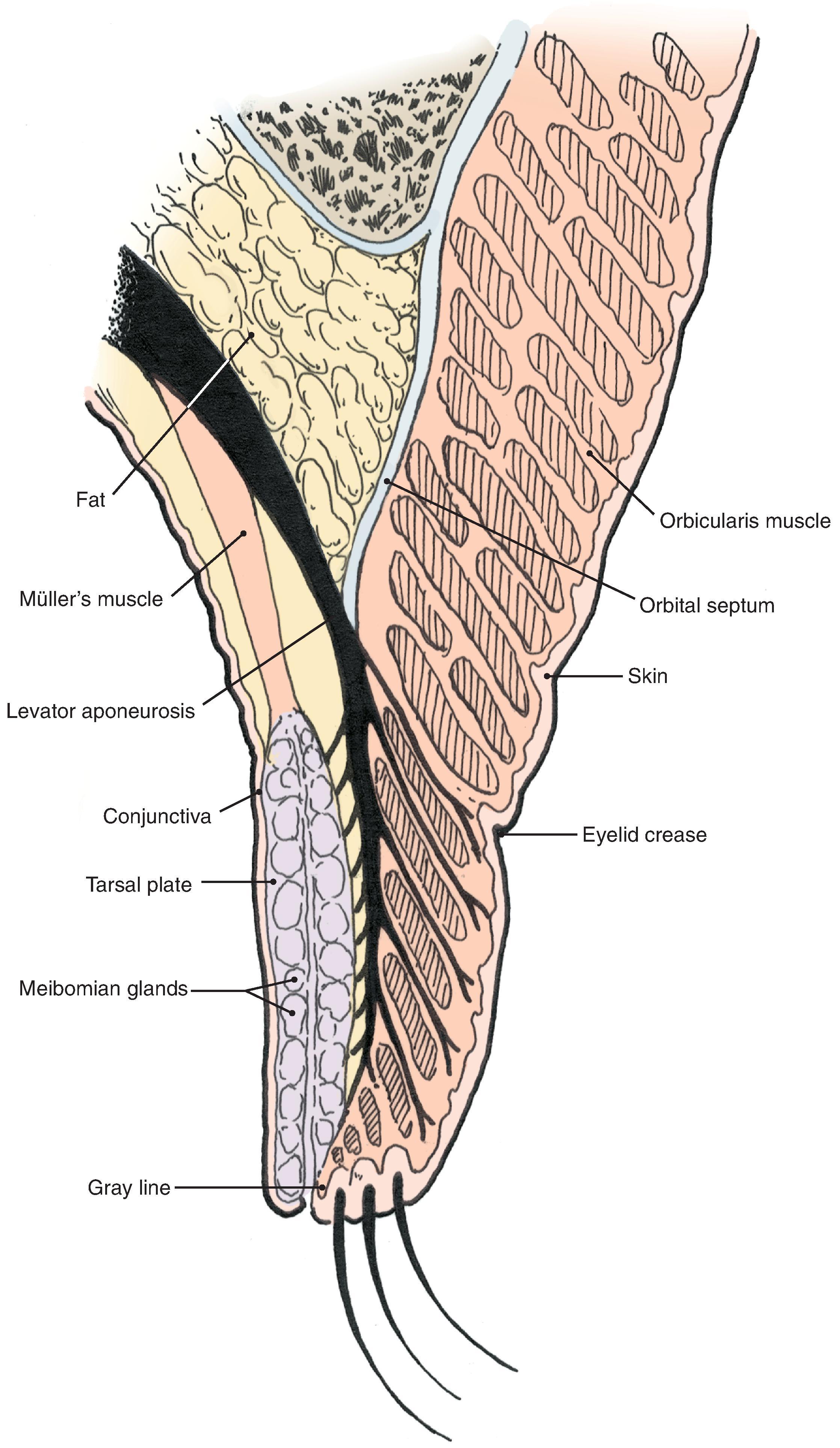 Fig. 17.1, Anatomy of the upper eyelid.