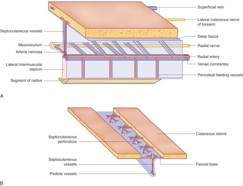 Figure 47.3, Radial forearm flap components.