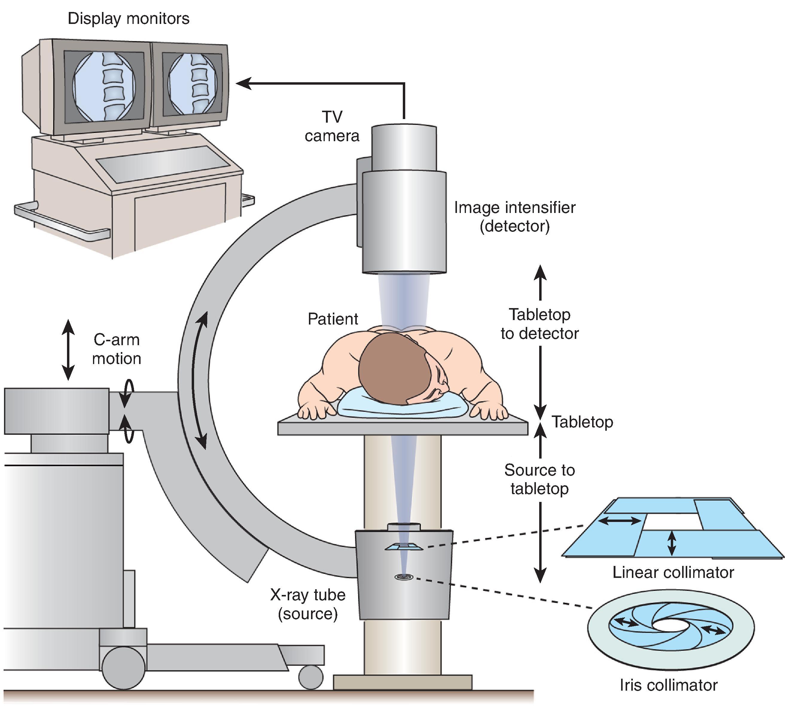 Figure 73.1, Diagram of the components of a typical fluoroscopy unit.