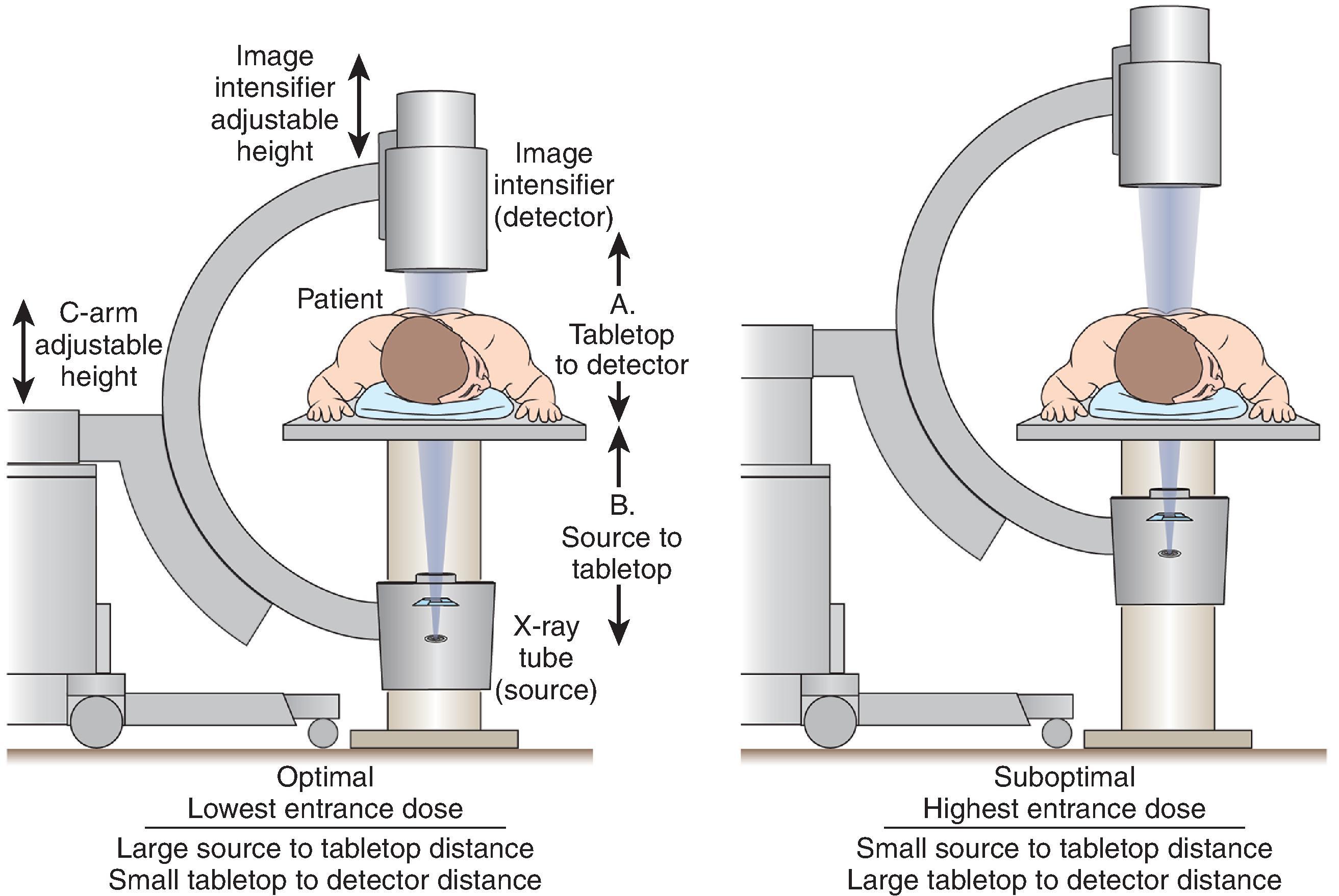 Figure 73.3, Effect of pulsed fluoroscopy on radiation dose (patient entrance skin dose). For example, by switching from continuous fluoroscopy (typically 30 pulses/second) to 15 pulses per second, dose savings of nearly 22% are achieved.