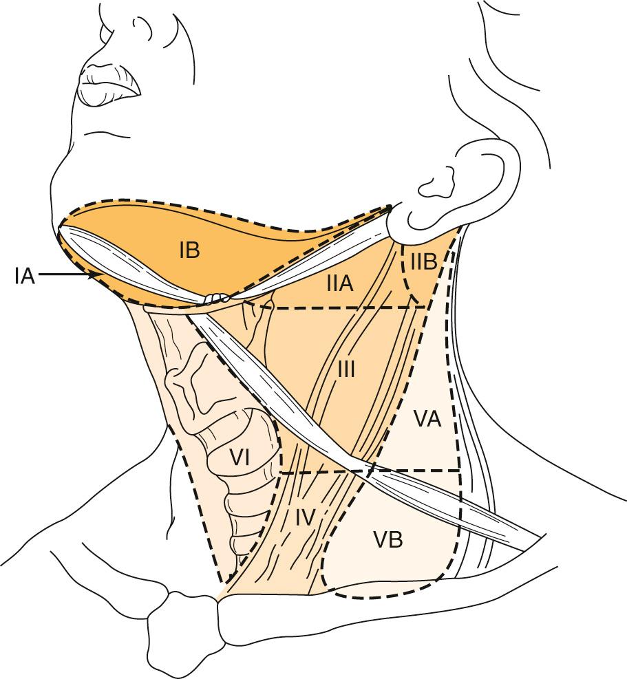 Fig. 110.2, Lymph node levels of the neck.