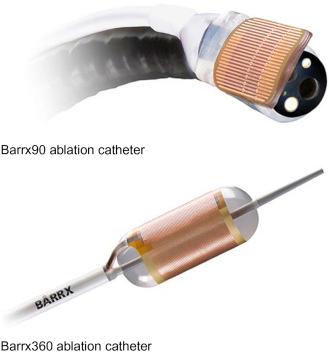 Figure 11.4, The Barrx 360 and Barrx 90 ablation catheters.