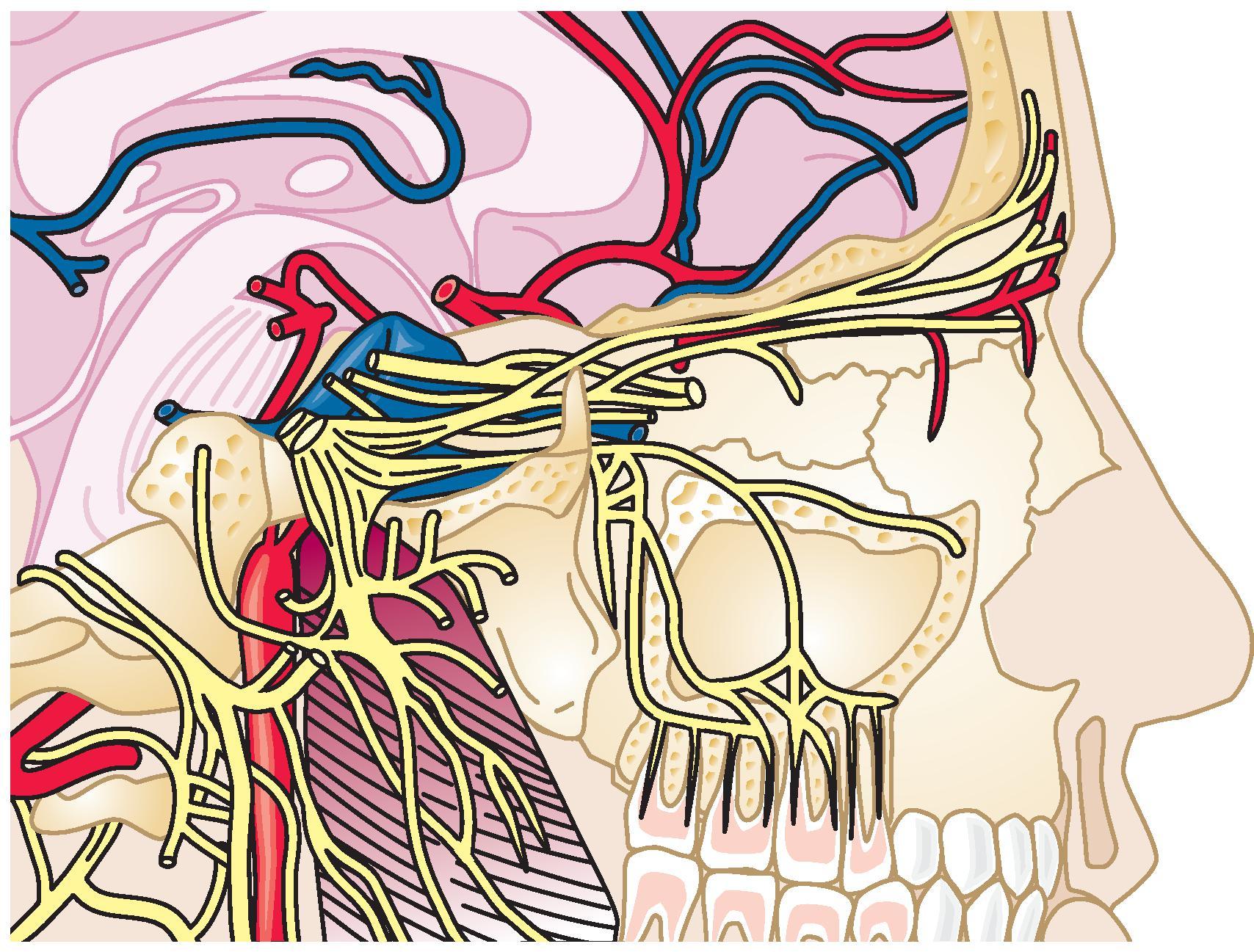 Figure 66.3, Anatomy of the gasserian ganglion and various trigeminal divisions.