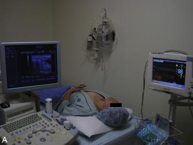 Fig. 16.3, Patient Preparation for Radiofrequency Ablation Procedure.