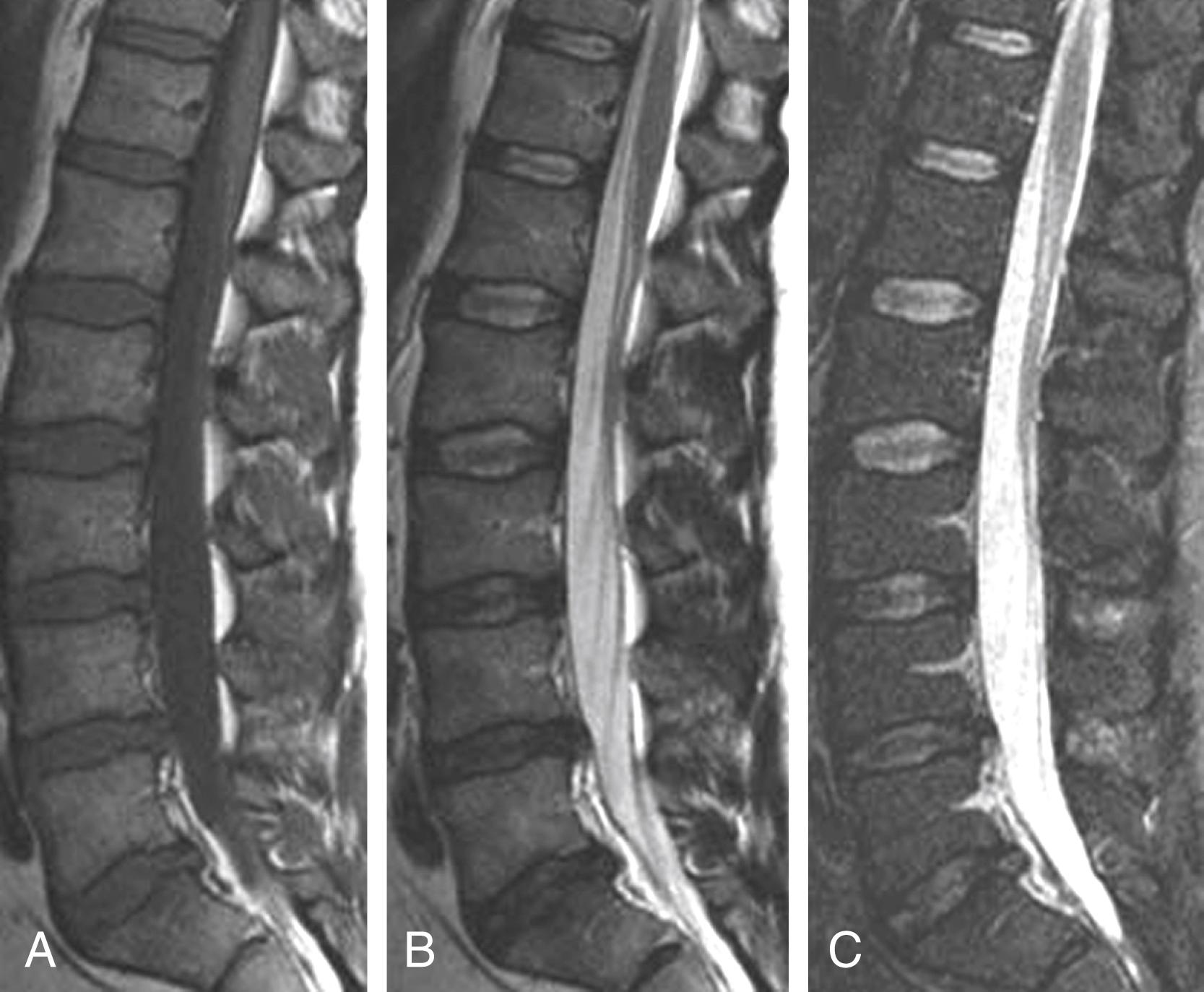 Figure 11.5, MRI sequences.