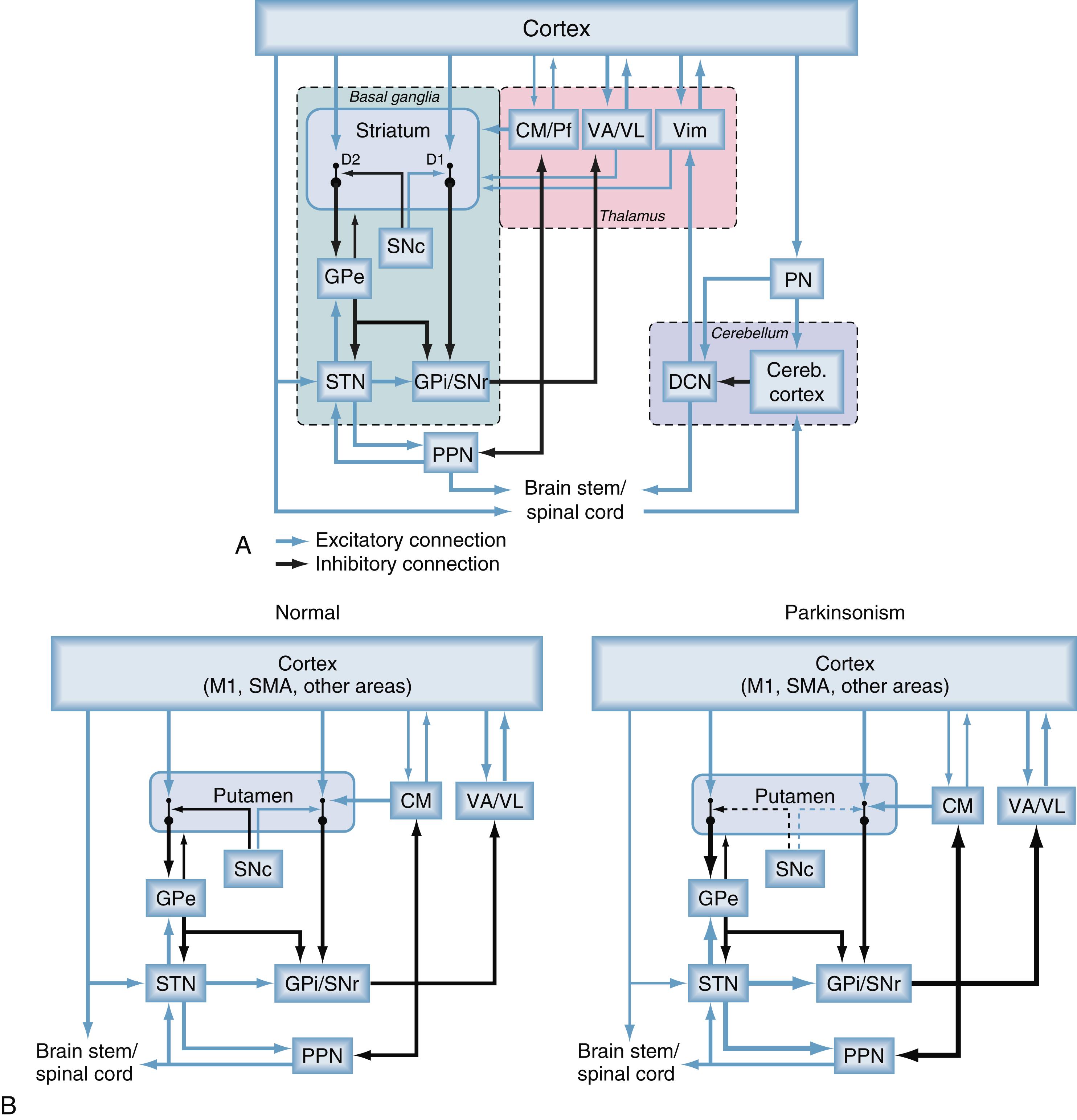 Figure 103.2, Parkinsonism-related changes in overall activity in the basal ganglia–thalamocortical motor circuit.