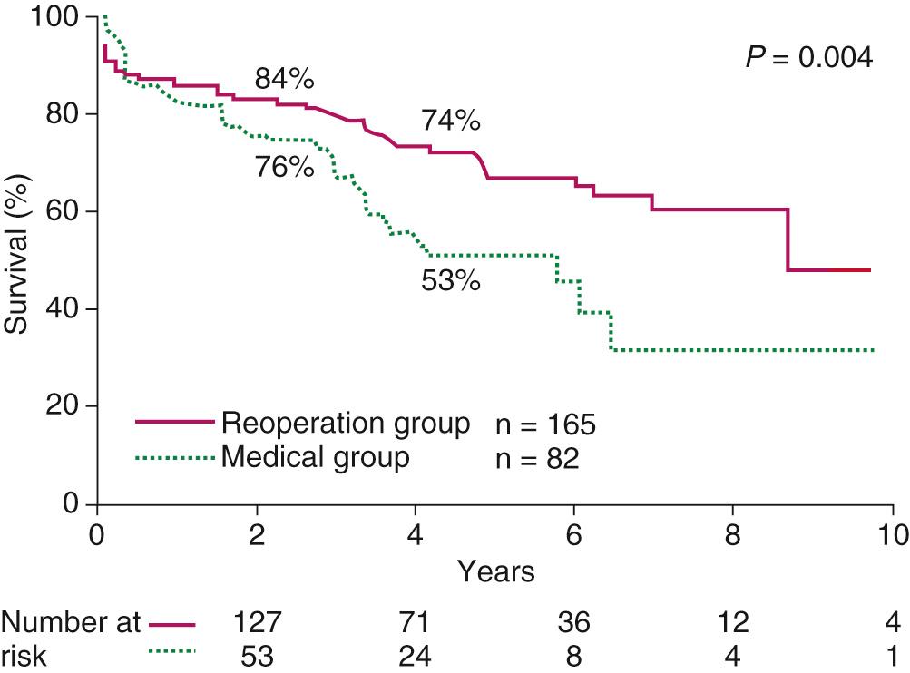 FIGURE 91-2, Comparison of late survival rates for patients with late stenoses of more than 50% in vein grafts subtending the left anterior descending coronary artery shows a distinct survival advantage for patients undergoing reoperation.
