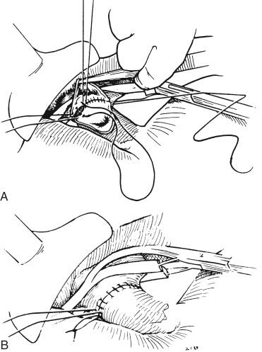 FIGURE 45-13